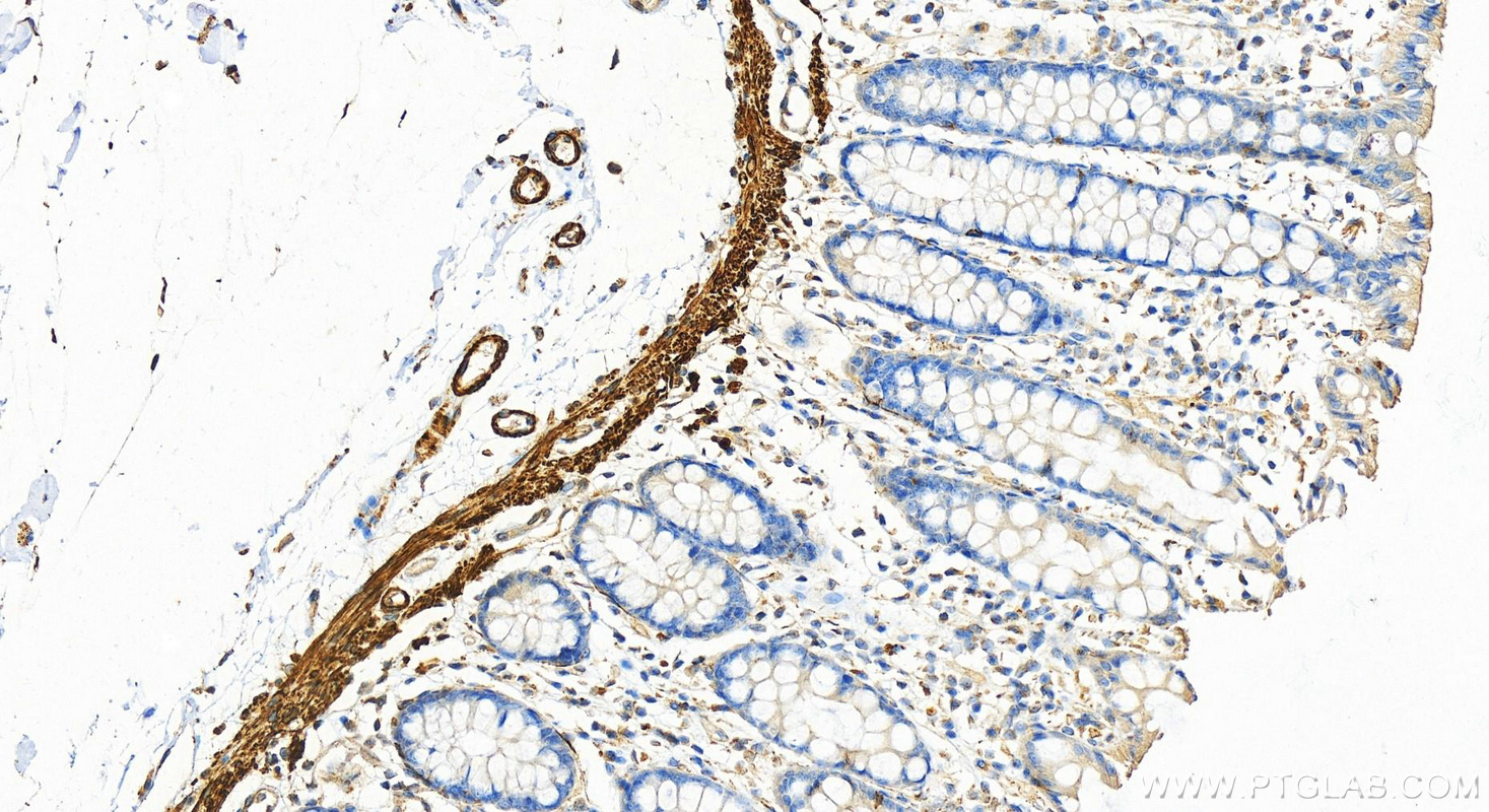 IHC staining of human colon using 16520-1-AP