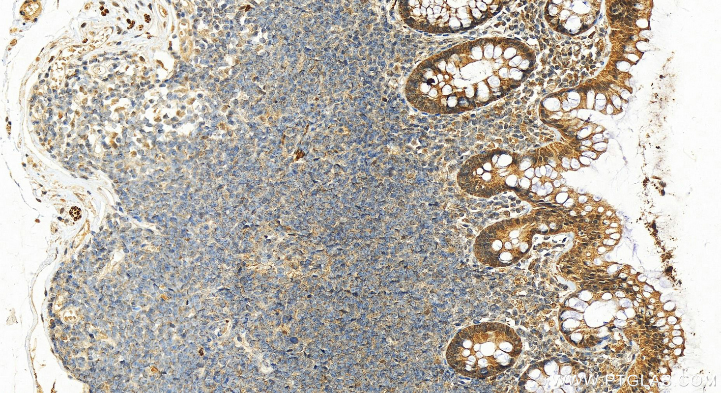 IHC staining of human normal colon using 22205-1-AP