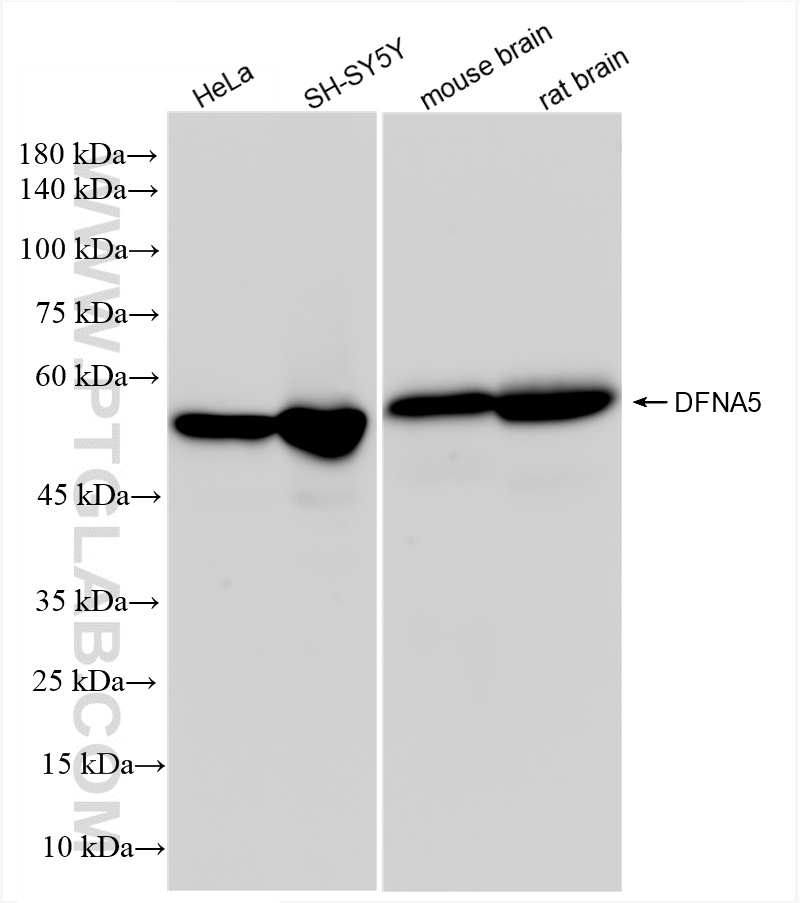 WB analysis using 83454-6-RR (same clone as 83454-6-PBS)