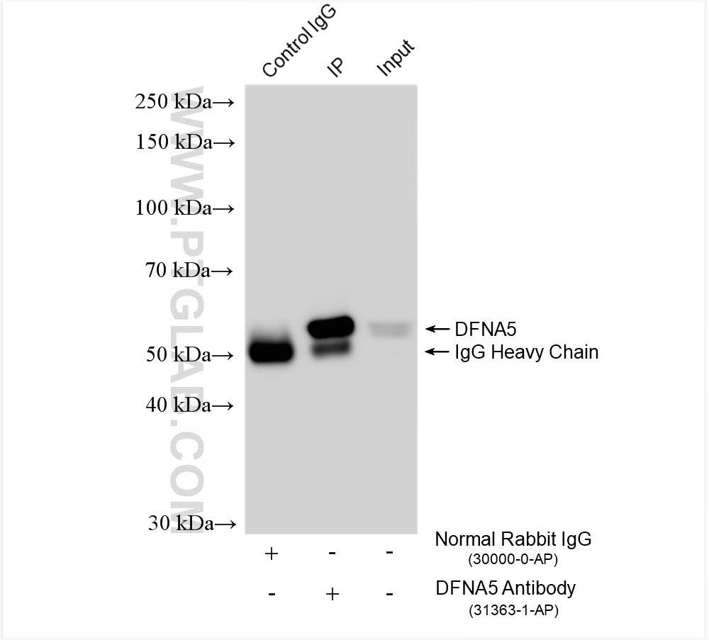 IP experiment of SH-SY5Y using 31363-1-AP