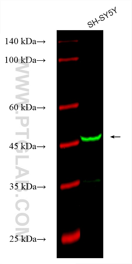 DFNA5