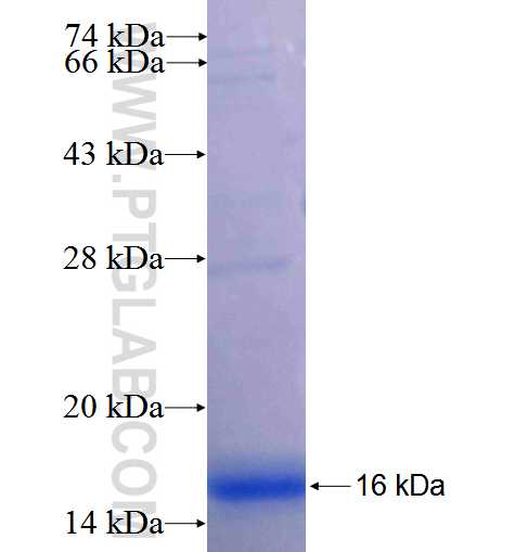 DFNB59 fusion protein Ag24361 SDS-PAGE