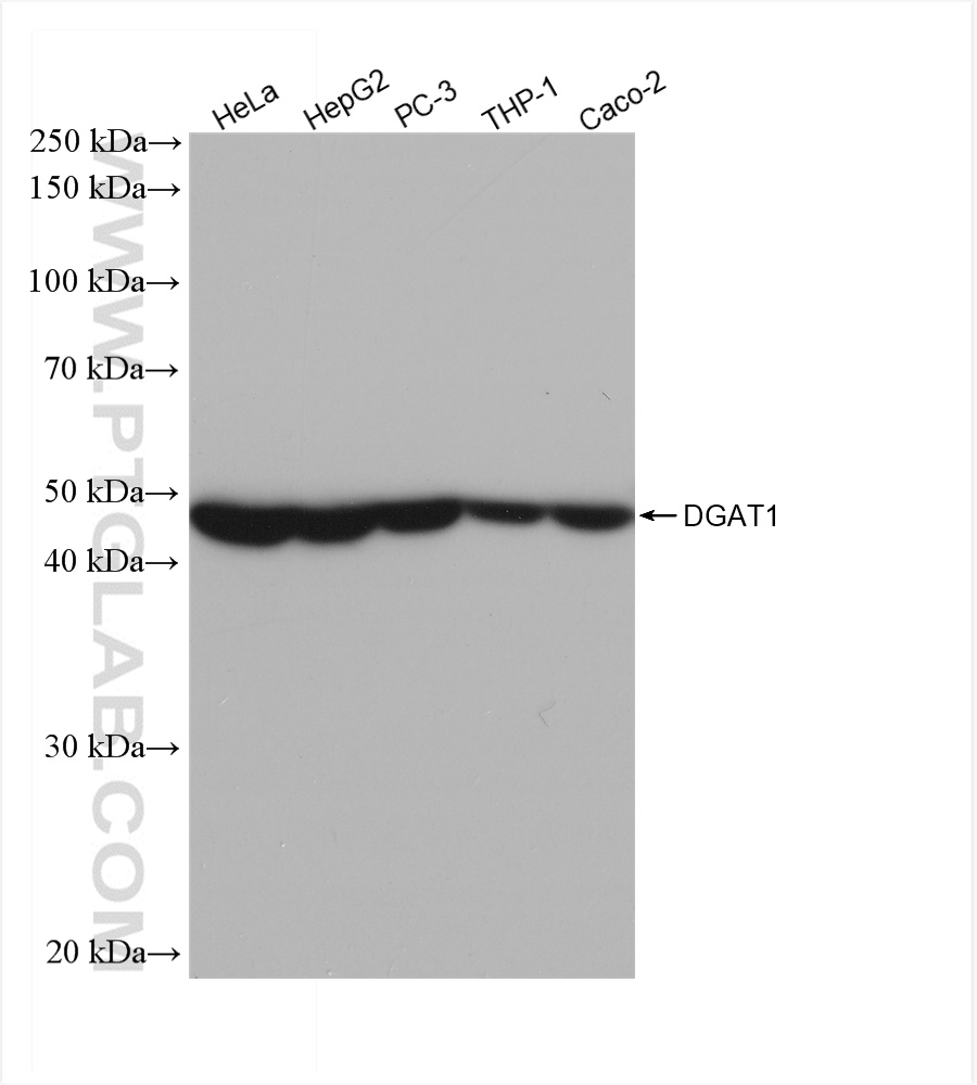 WB analysis using 82945-1-RR