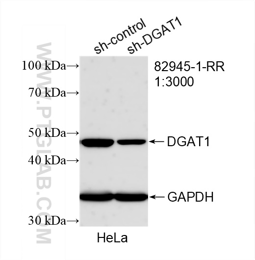 WB analysis of HeLa using 82945-1-RR (same clone as 82945-1-PBS)