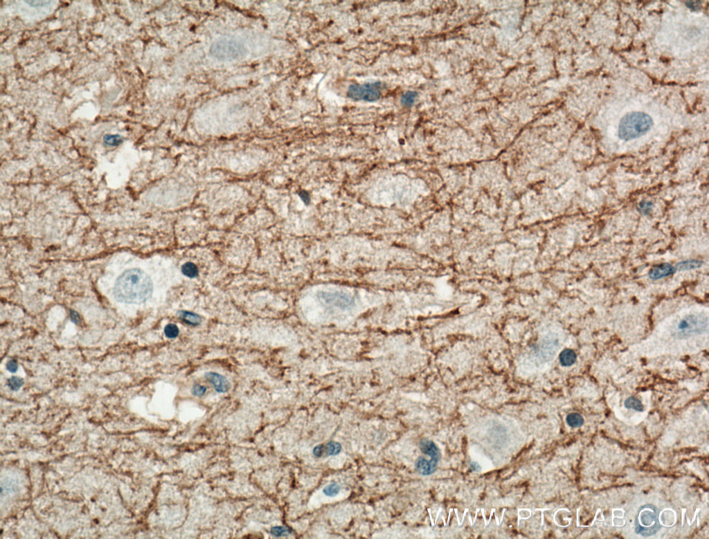 IHC staining of human brain using 13705-1-AP