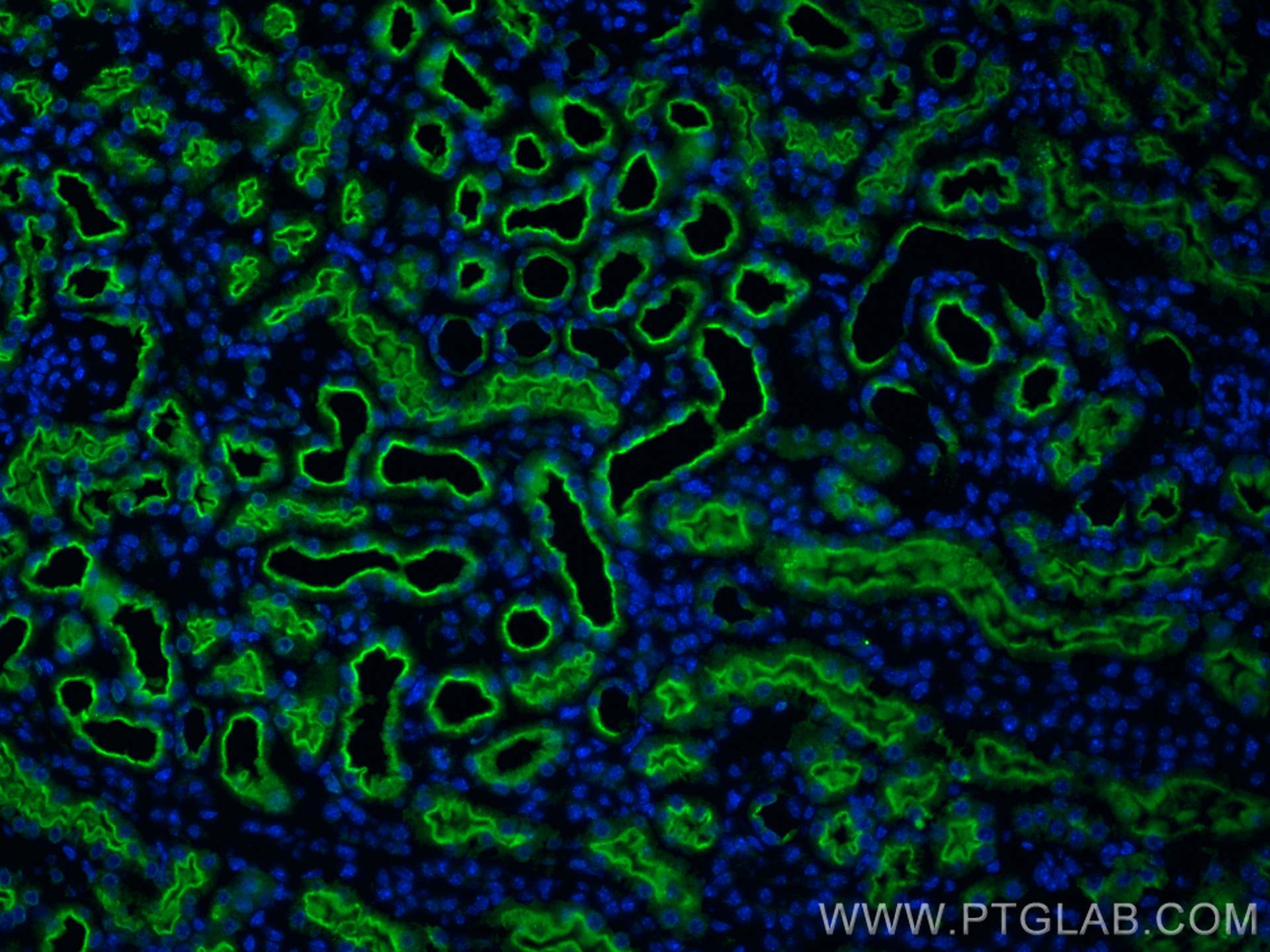 IF Staining of mouse kidney using 17885-1-AP