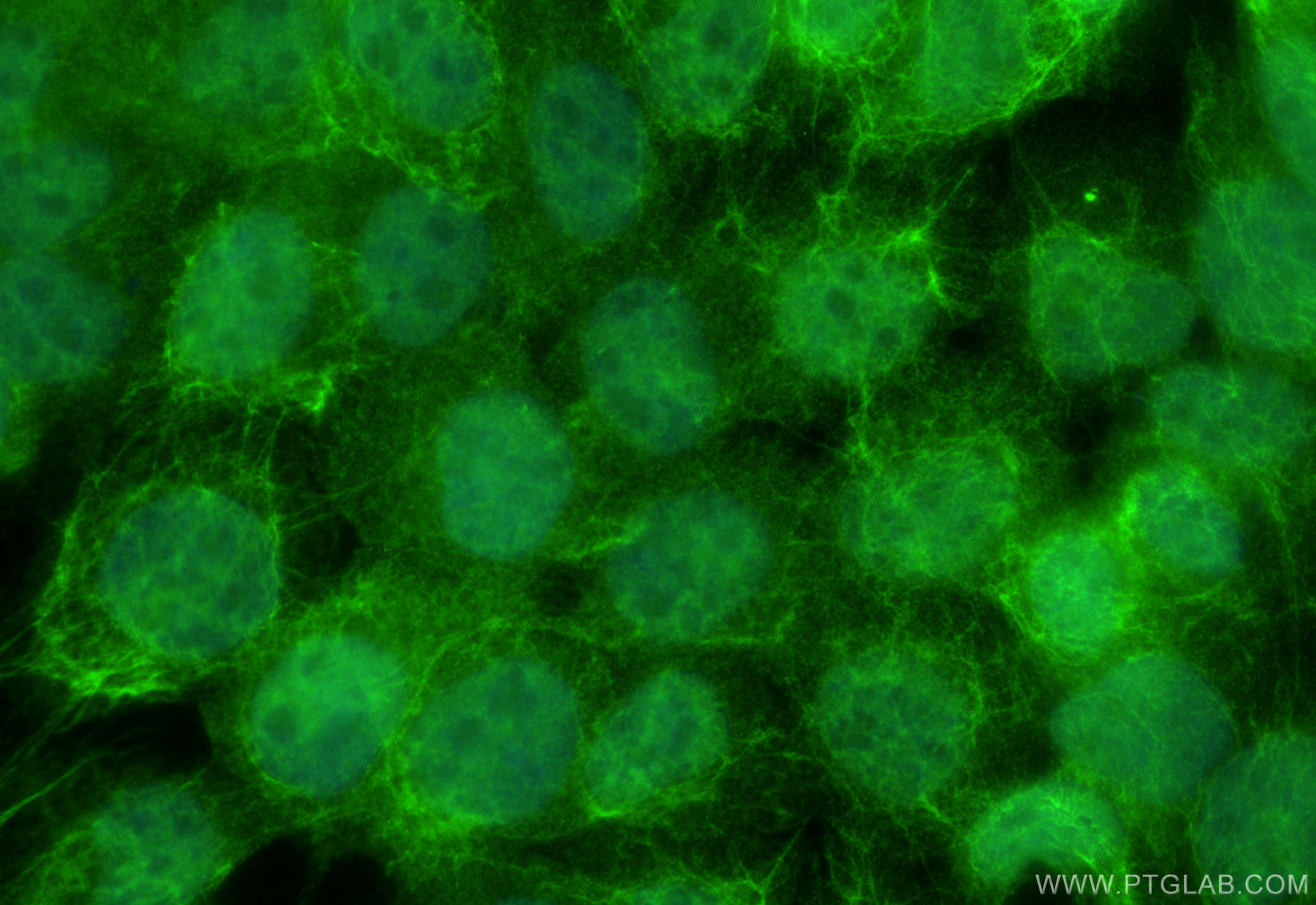 IF Staining of A431 using 32124-1-AP