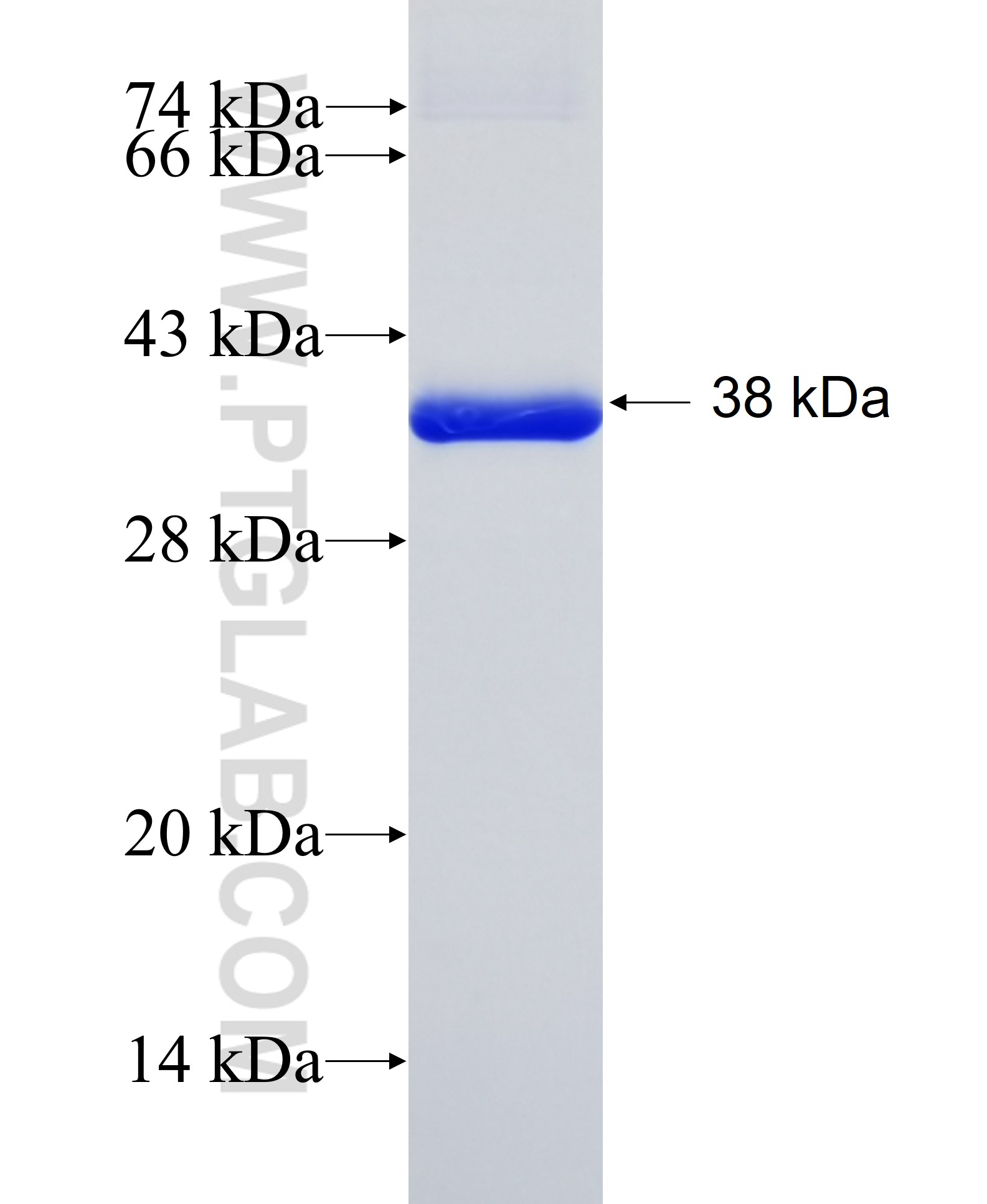 DGKZ fusion protein Ag5074 SDS-PAGE