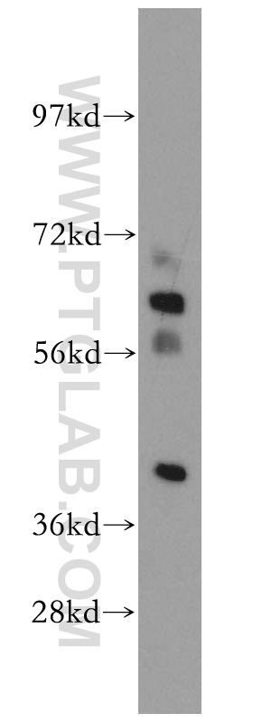 WB analysis of mouse testis using 13900-1-AP