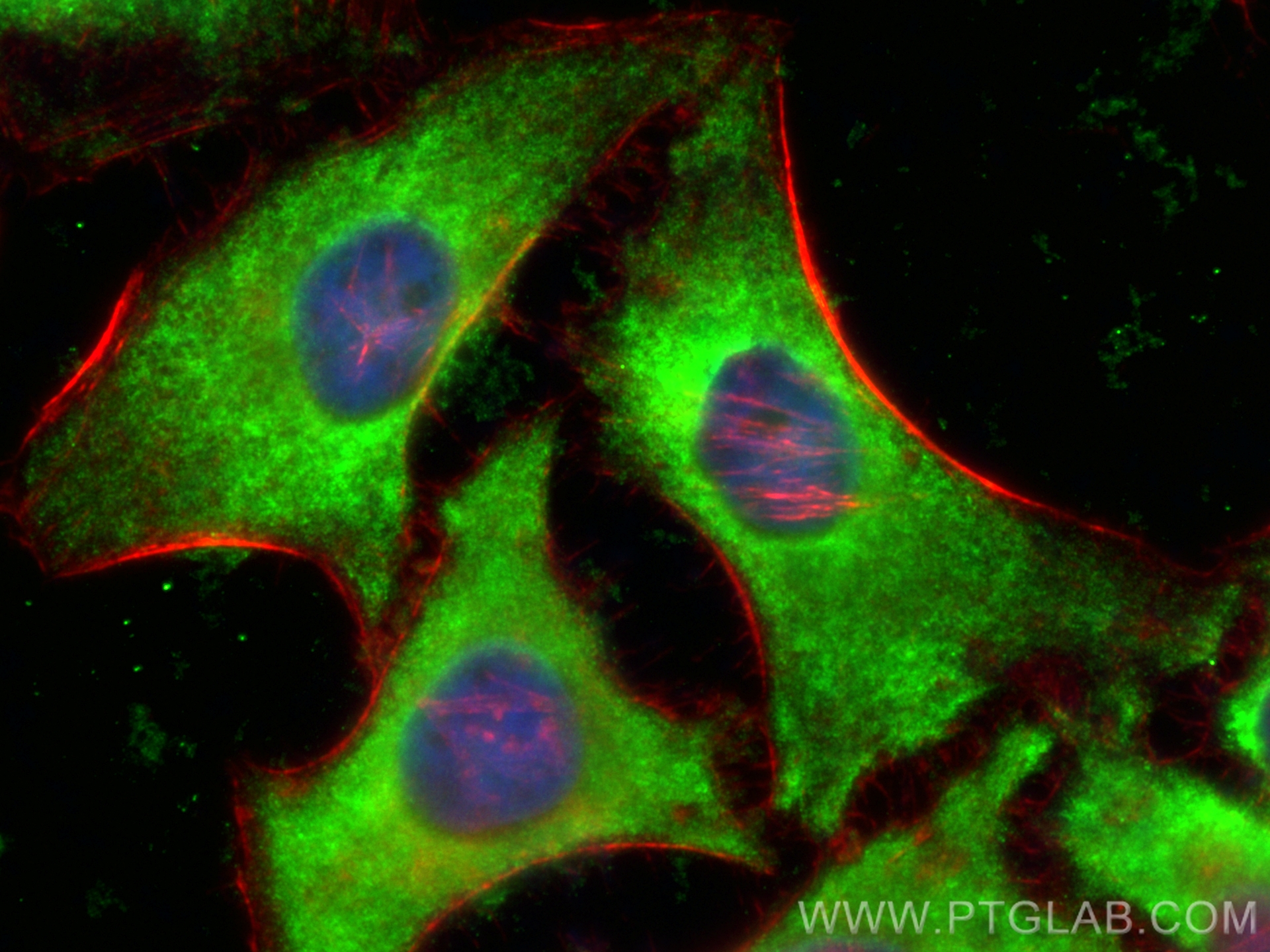 IF Staining of HeLa using CL488-11184