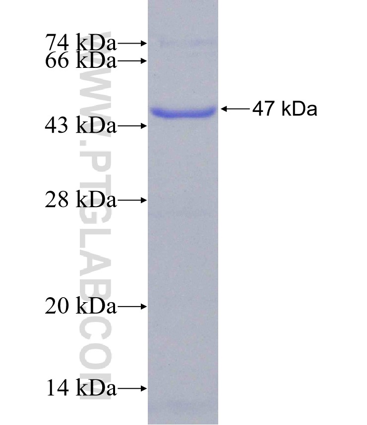 DHPS fusion protein Ag31046 SDS-PAGE