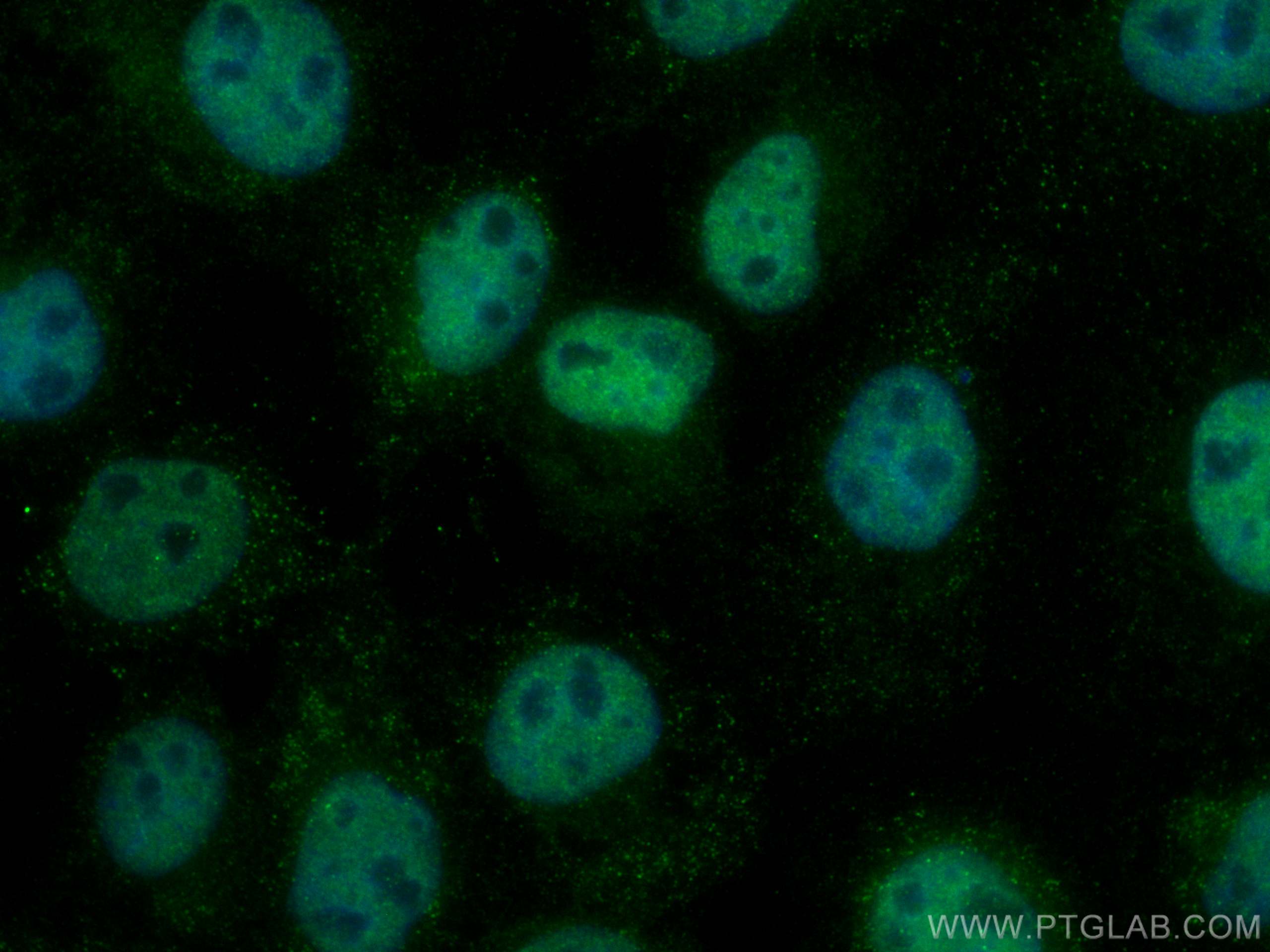 IF Staining of A431 using 16275-1-AP