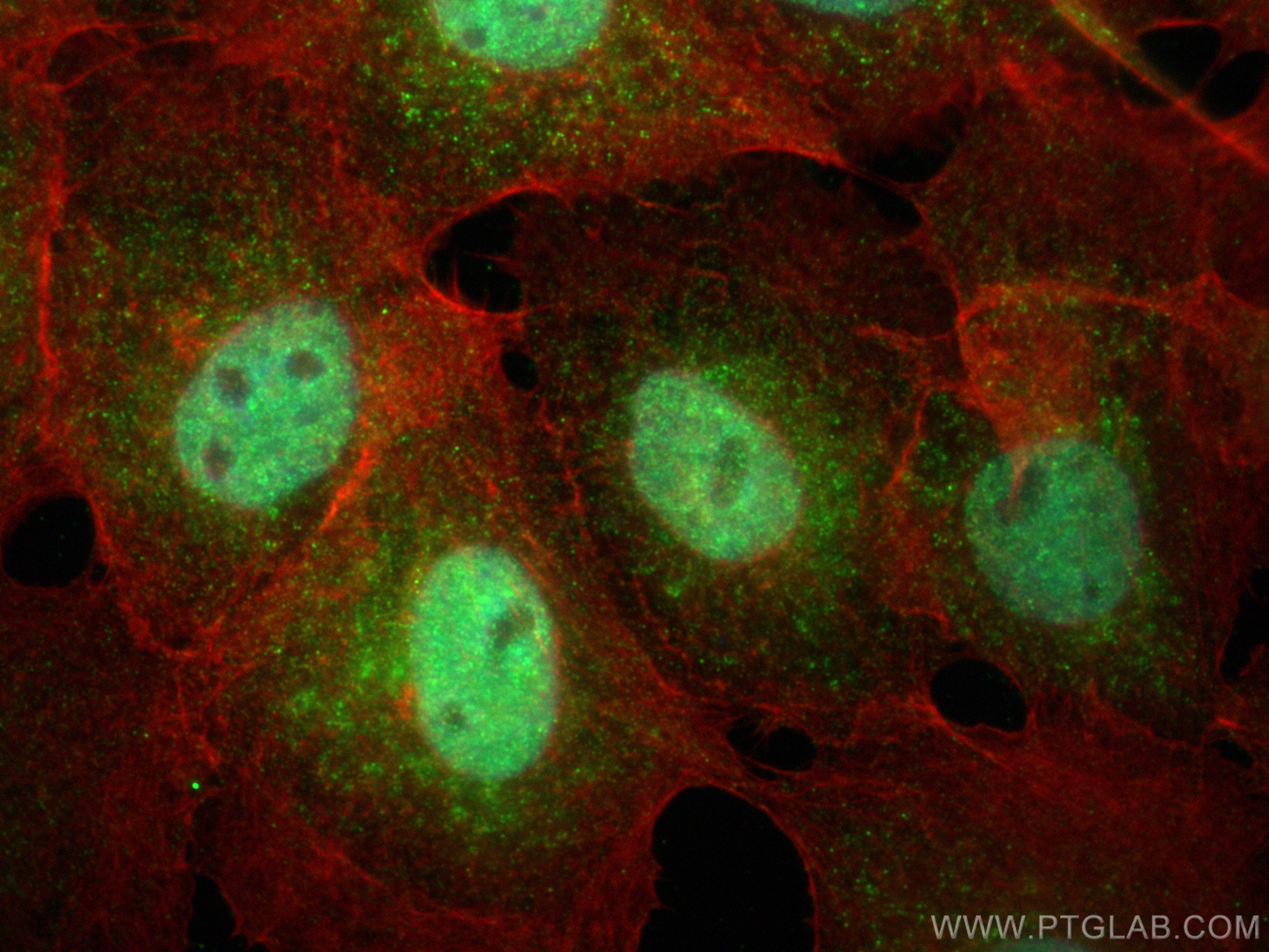 IF Staining of A431 using 16275-1-AP