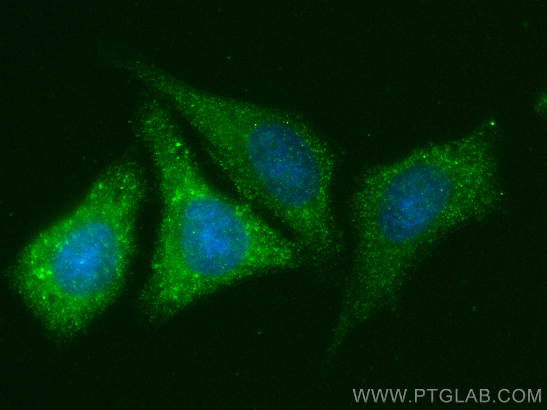 IF Staining of HepG2 using 83581-3-RR