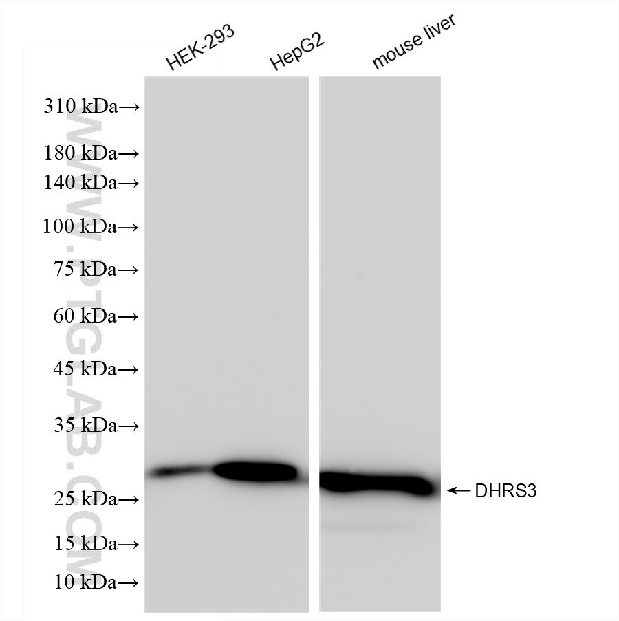 WB analysis using 83581-3-RR