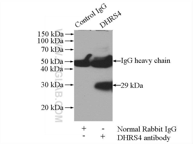 IP experiment of mouse liver using 15279-1-AP