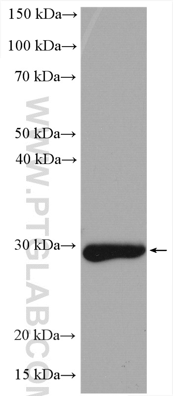 WB analysis of rat liver using 15279-1-AP