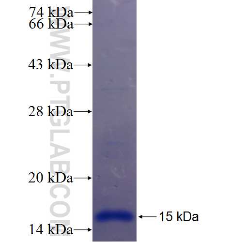 DHRS7C fusion protein Ag23392 SDS-PAGE