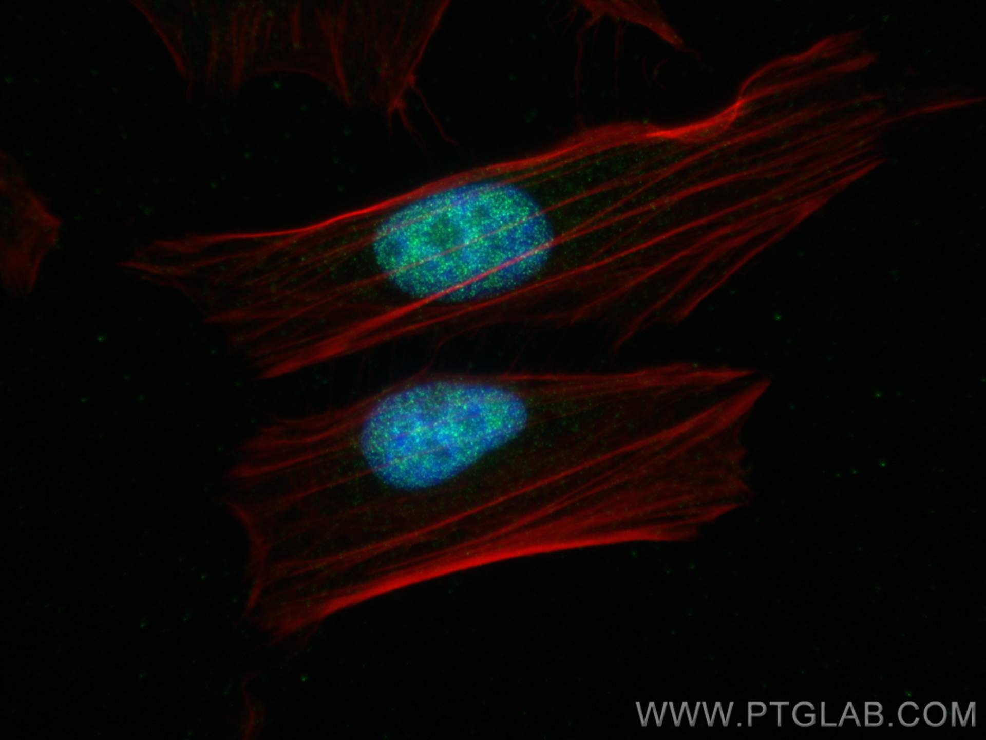 IF Staining of HeLa using 82137-1-RR