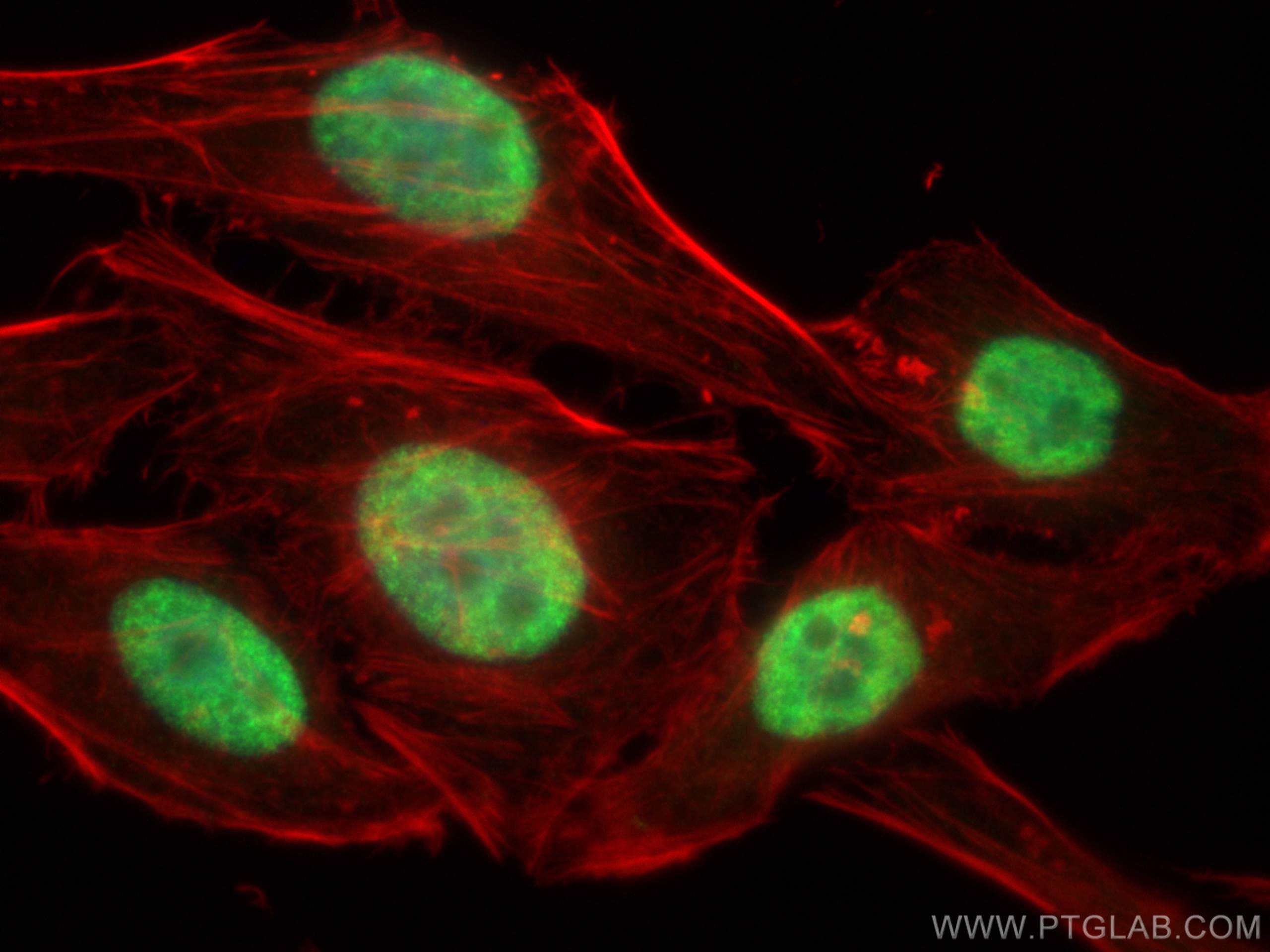 IF Staining of HepG2 using 17721-1-AP