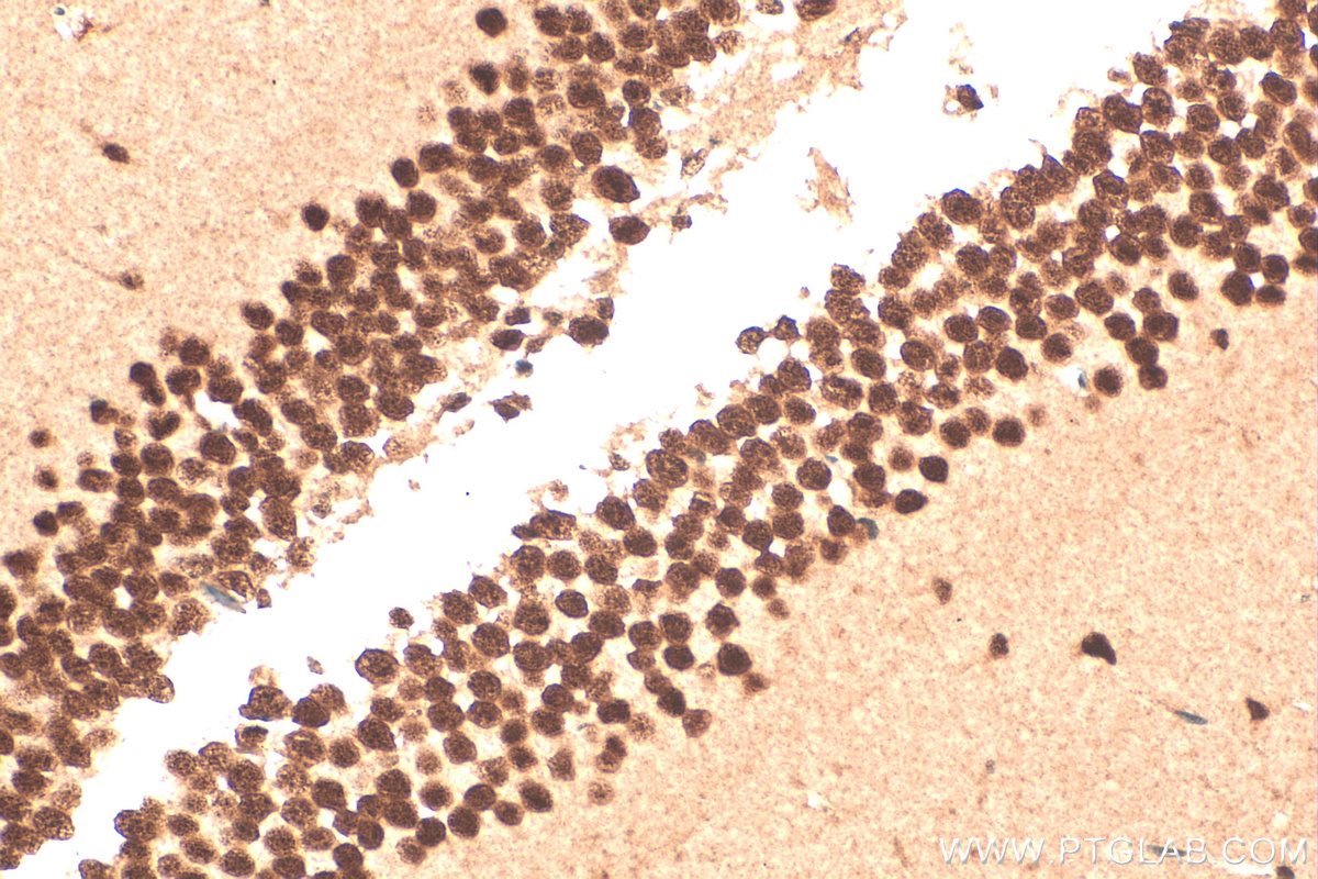 IHC staining of mouse brain using 17721-1-AP