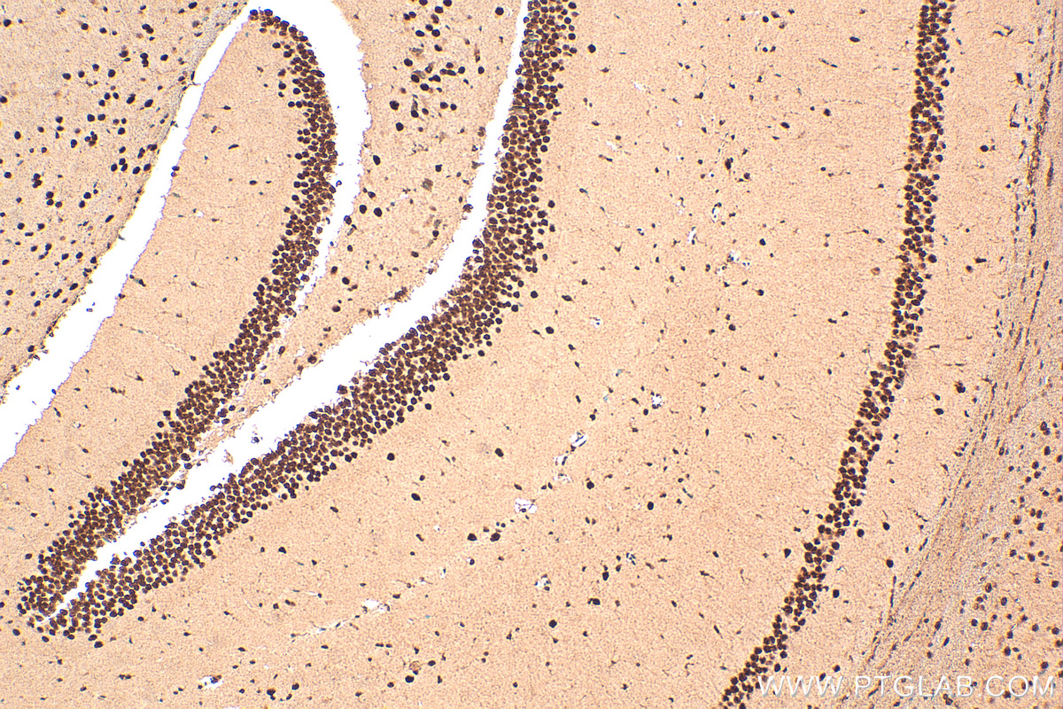 IHC staining of mouse brain using 17721-1-AP