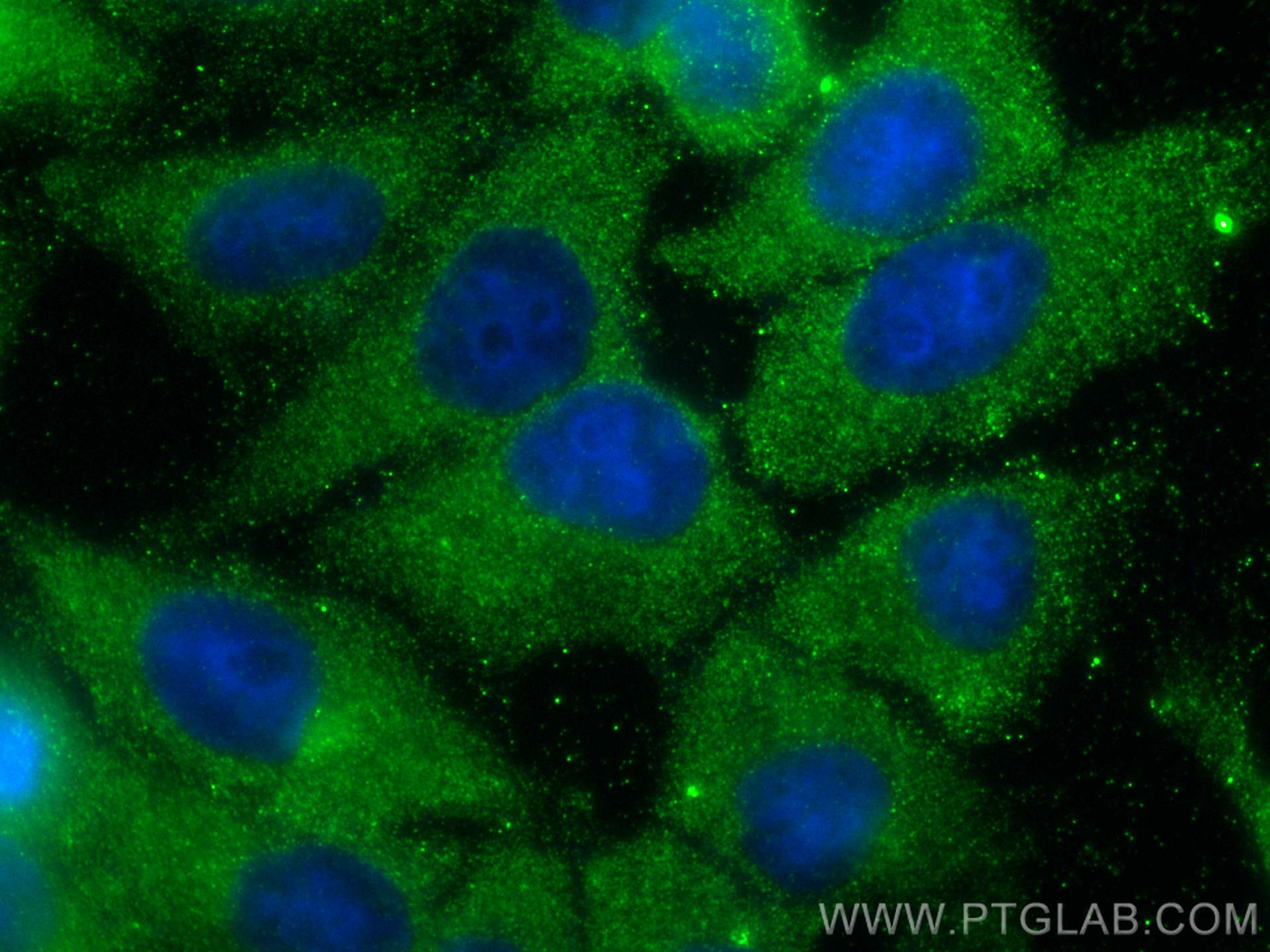 IF Staining of HepG2 using 20567-1-AP (same clone as 20567-1-PBS)