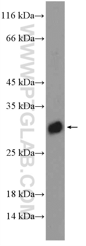 WB analysis of mouse lung using 11790-1-AP