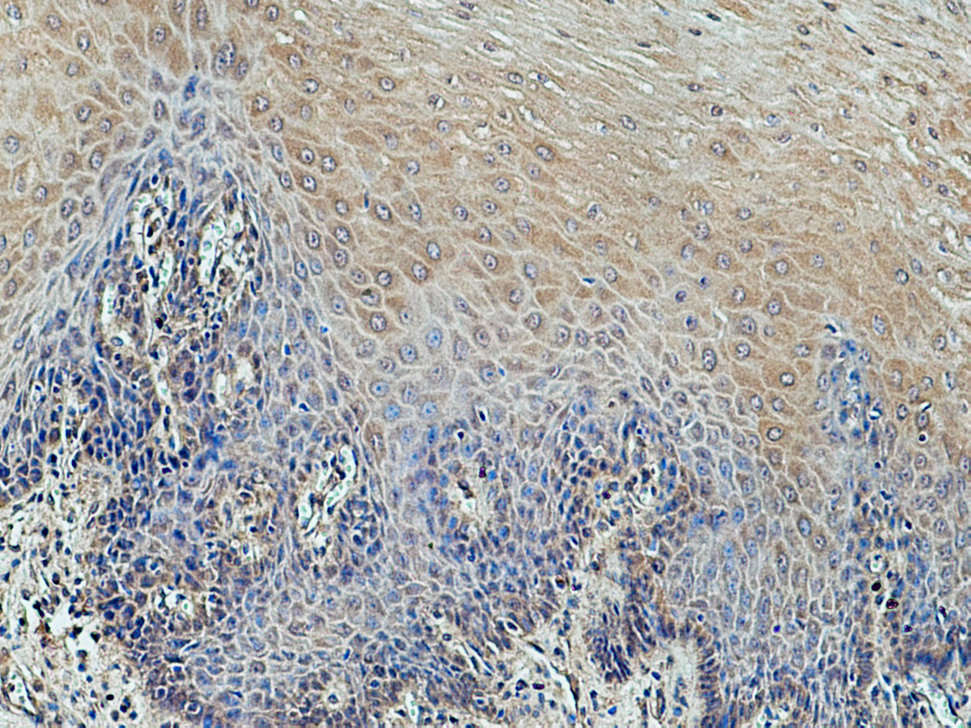 IHC staining of human oesophagus using 12634-1-AP