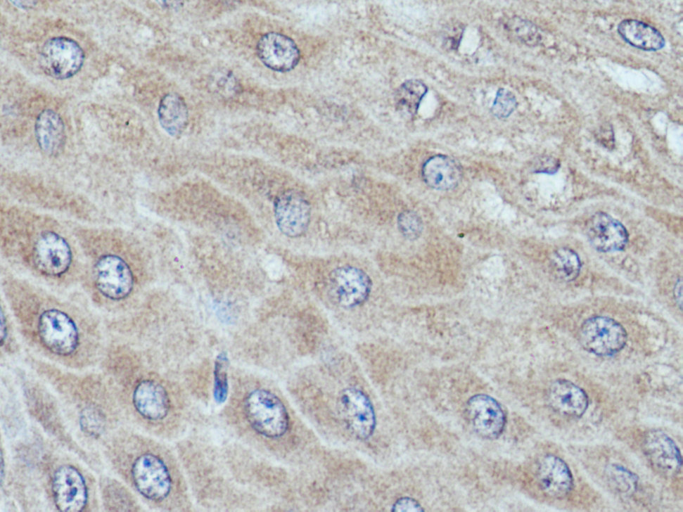 IHC staining of human oesophagus using 12634-1-AP