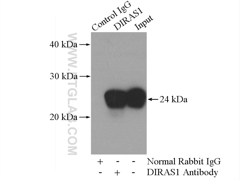 IP experiment of mouse brain using 12634-1-AP