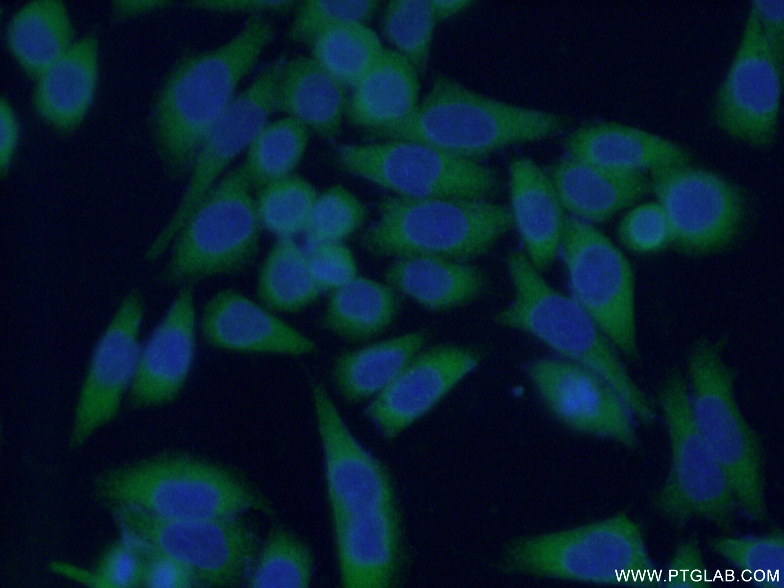 IF Staining of HeLa using 15557-1-AP