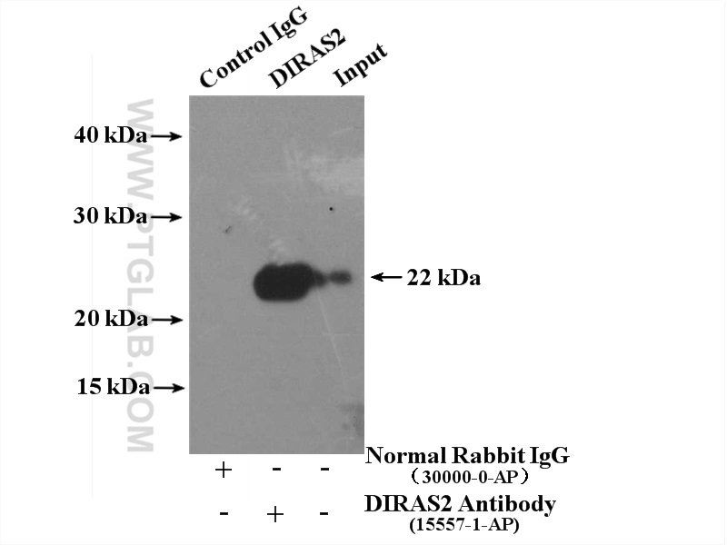 IP experiment of mouse brain using 15557-1-AP