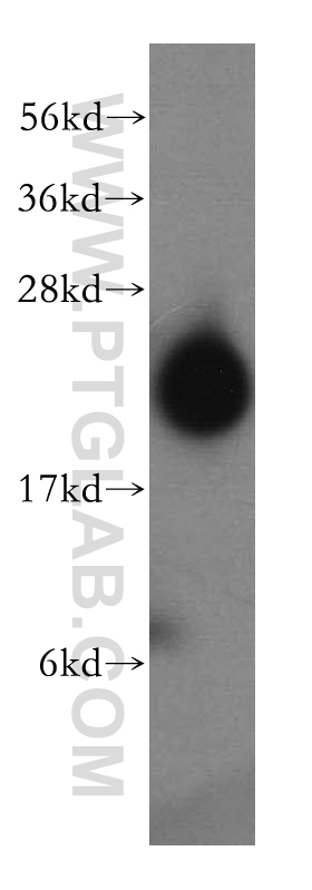 WB analysis of human brain using 15557-1-AP