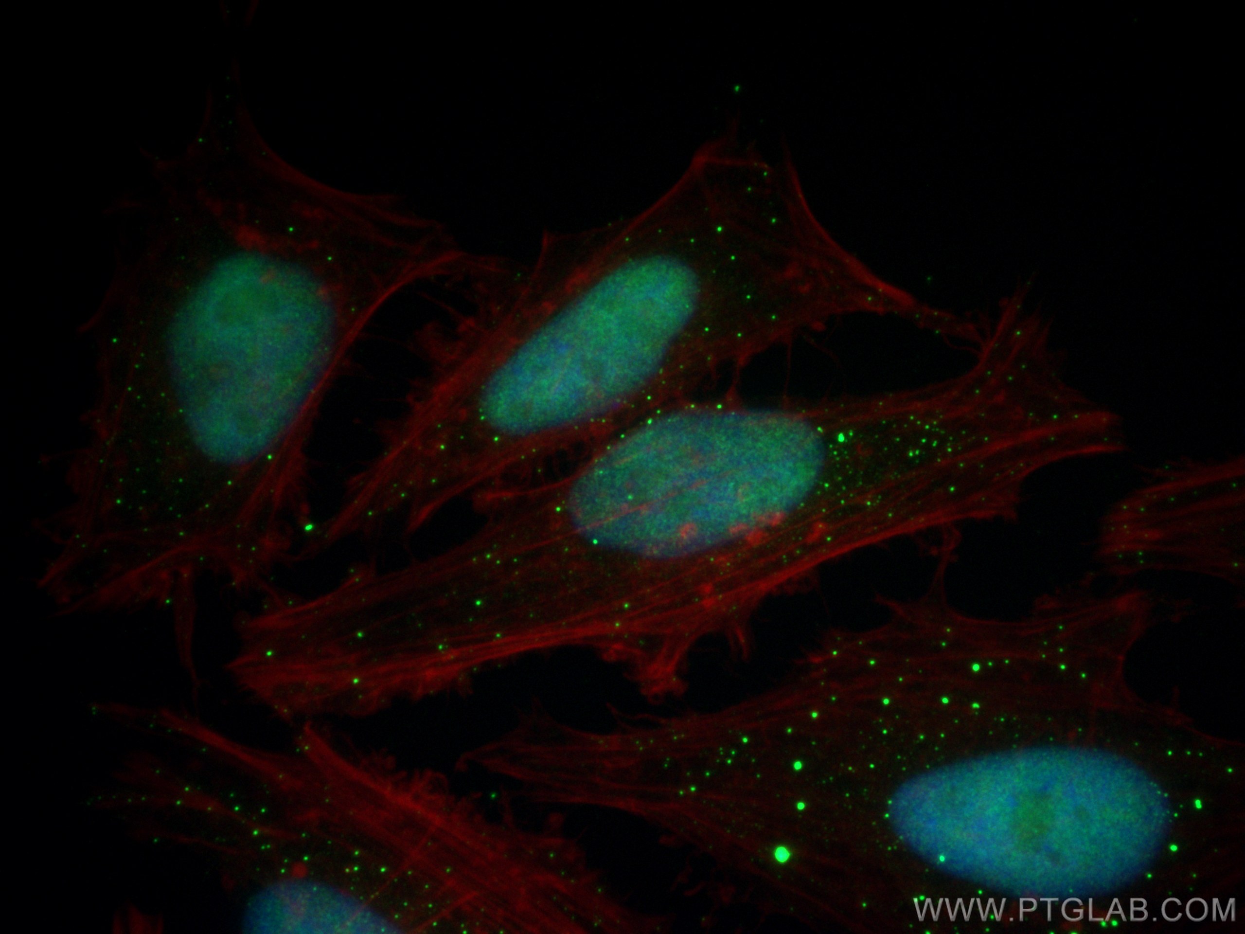 IF Staining of HeLa using 29664-1-AP