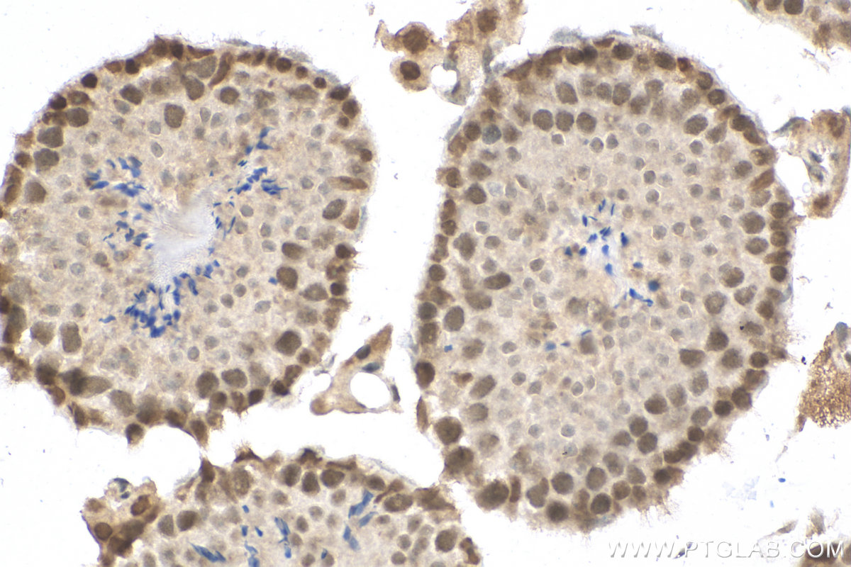 IHC staining of mouse testis using 29664-1-AP