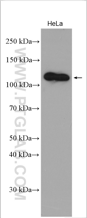 WB analysis using 29664-1-AP