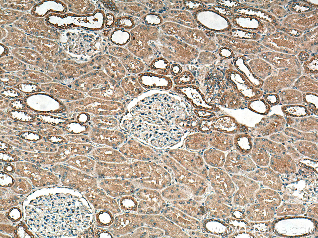 IHC staining of human kidney using 12041-1-AP