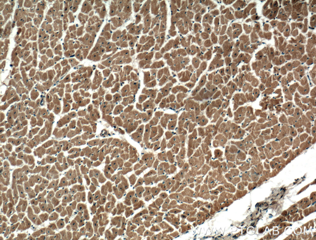 IHC staining of human heart using 13816-1-AP