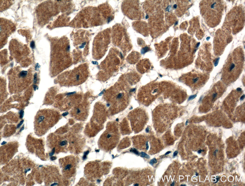 IHC staining of human heart using 13816-1-AP