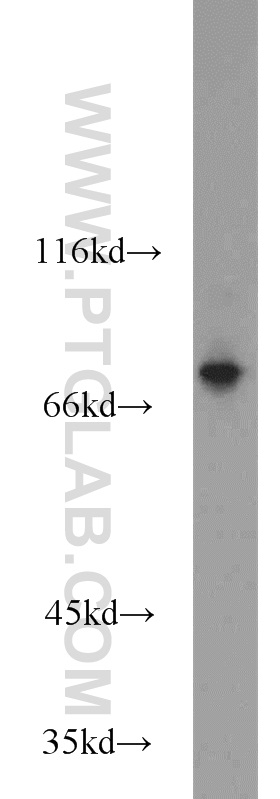 WB analysis of mouse skeletal muscle using 13816-1-AP