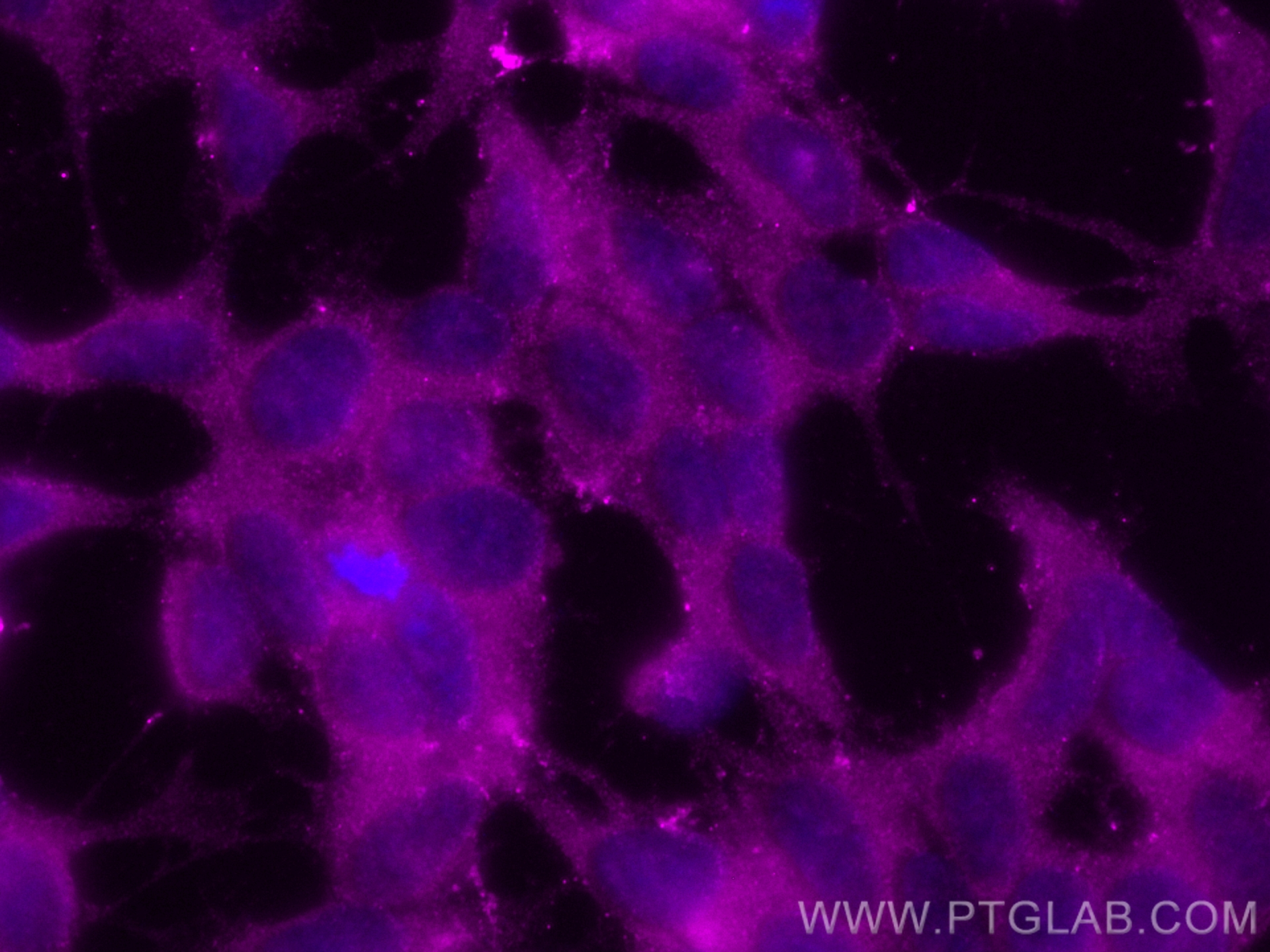 IF Staining of SH-SY5Y using CL647-10365