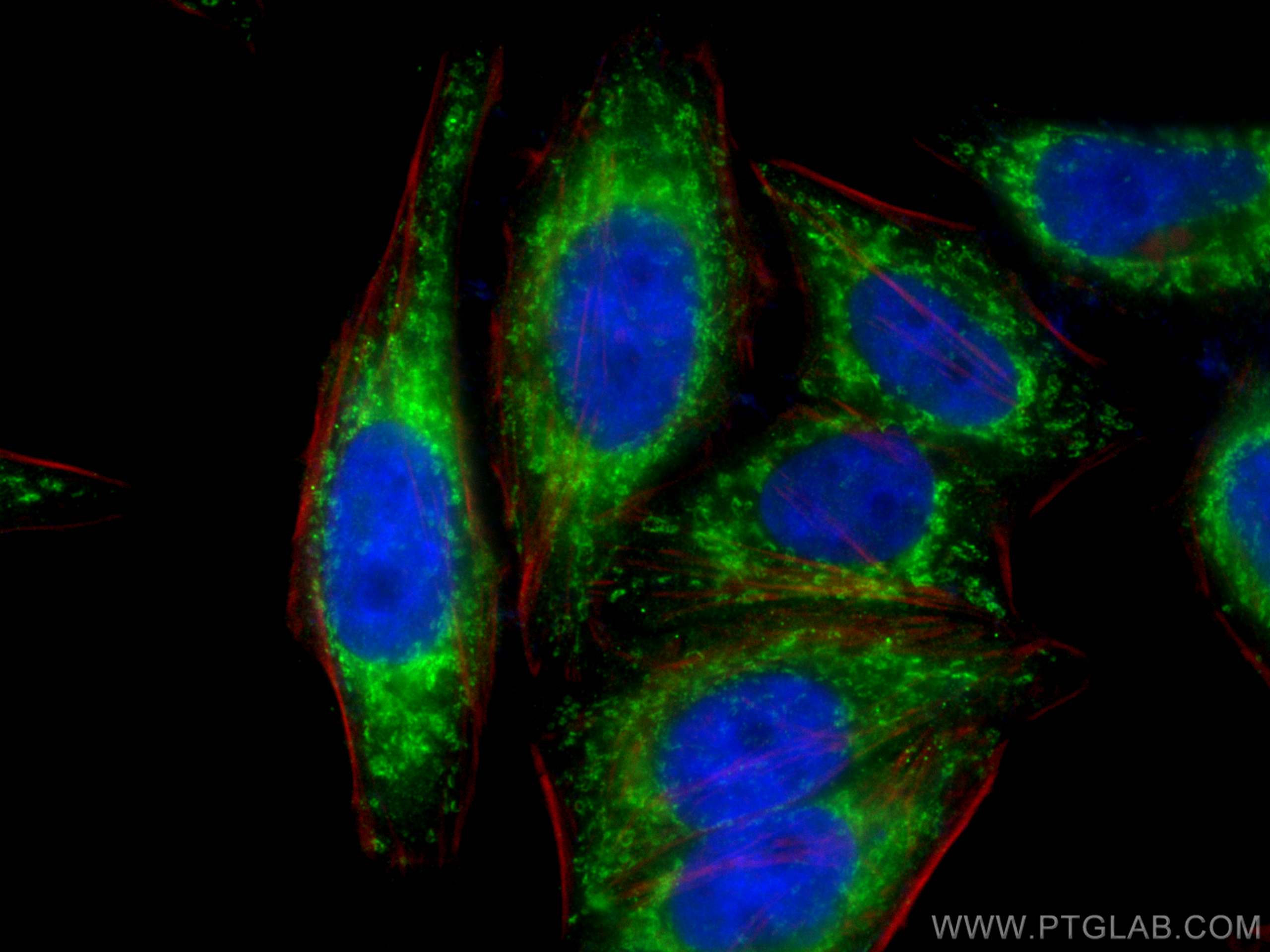 IF Staining of HepG2 using 16431-1-AP