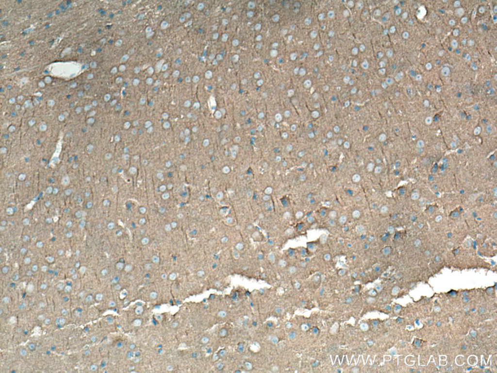 IHC staining of mouse brain using 67102-1-Ig (same clone as 67102-1-PBS)