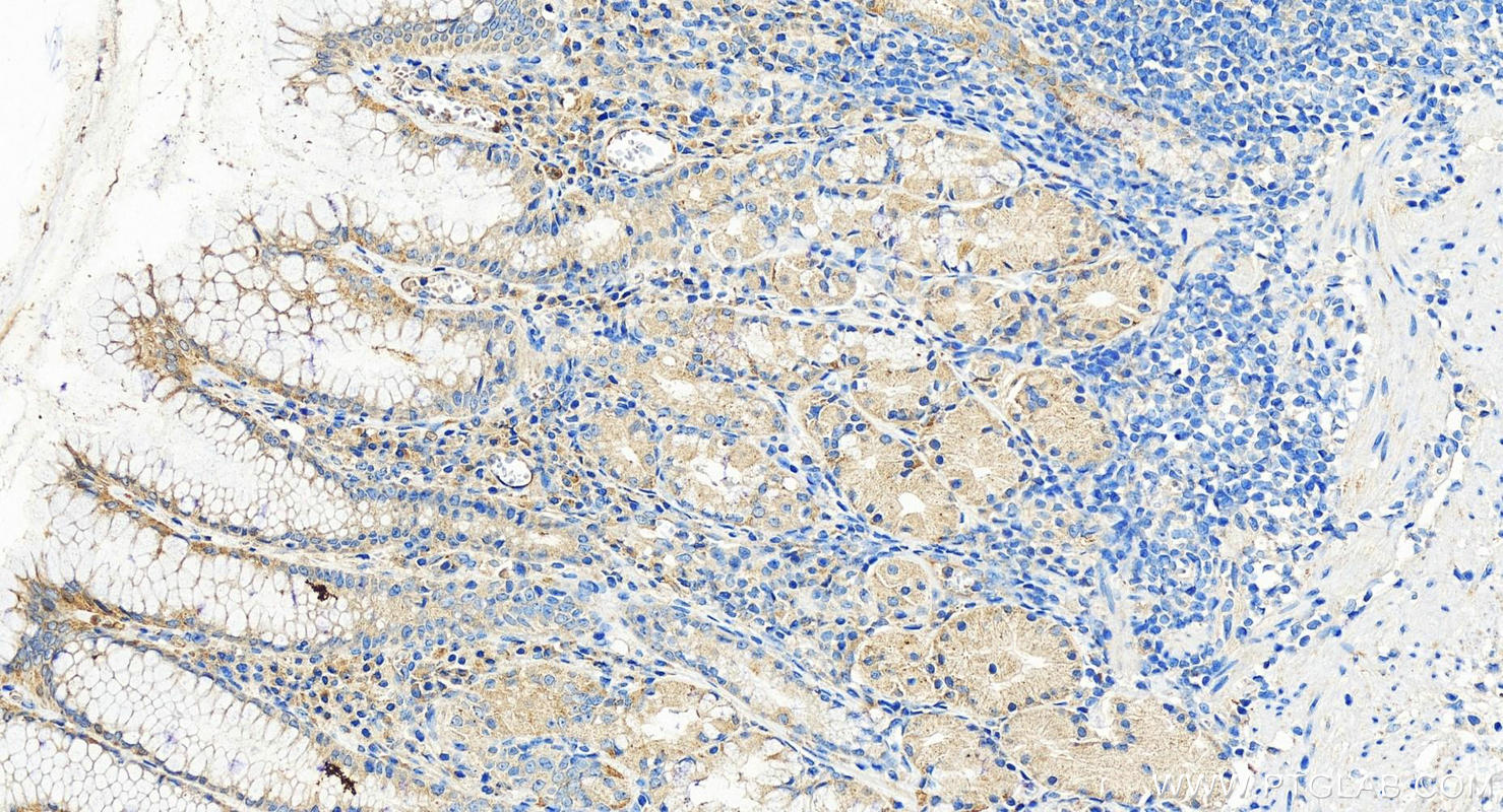 IHC staining of human stomach using 55056-1-AP