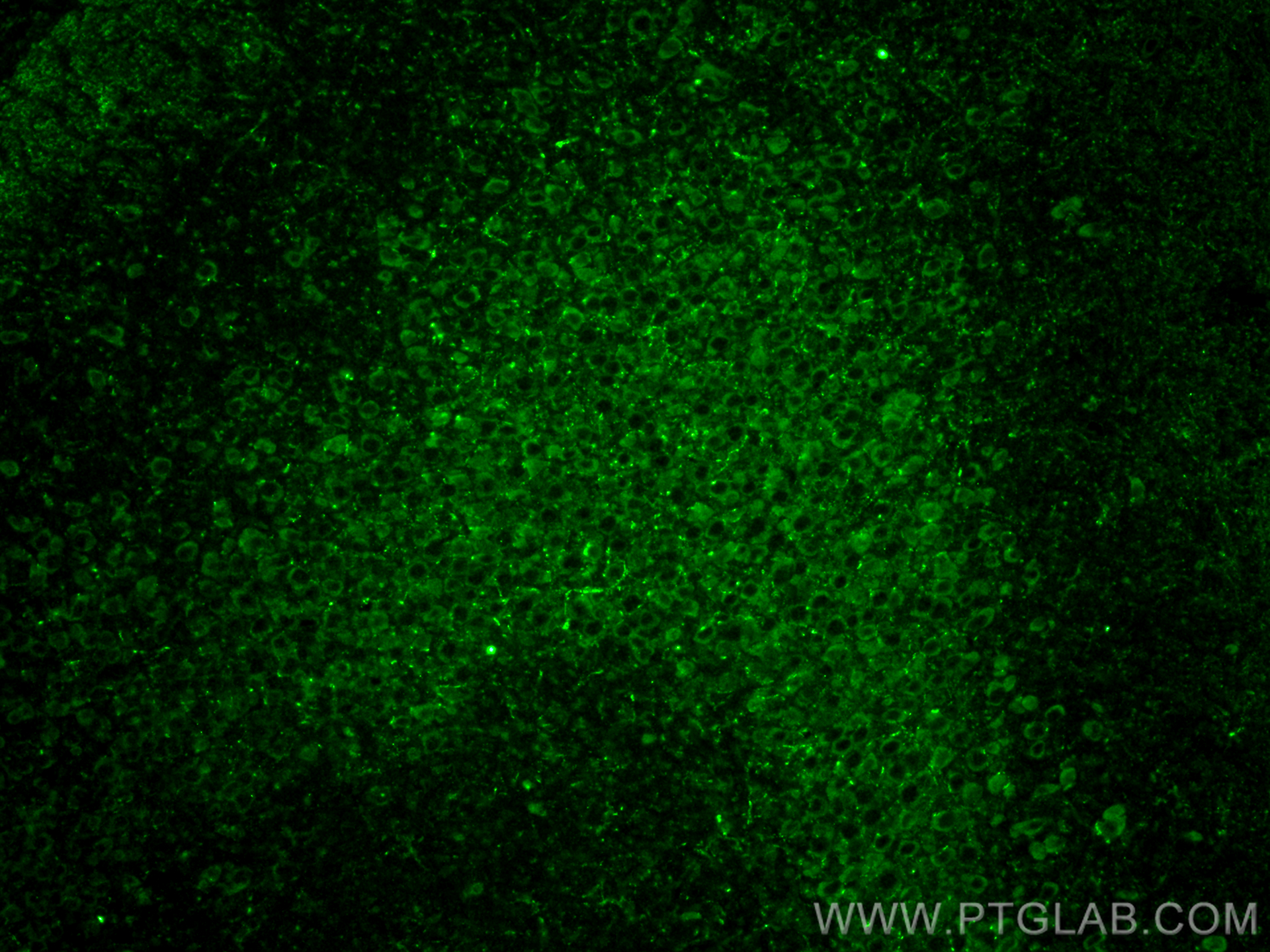 IF Staining of mouse brain using 25535-1-AP