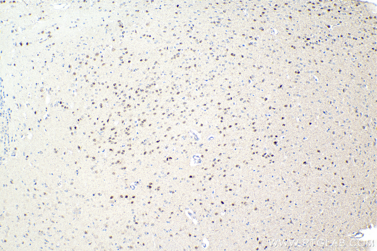 IHC staining of mouse brain using 13046-1-AP