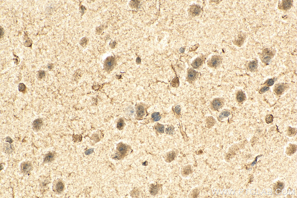 IHC staining of mouse brain using 67111-1-Ig (same clone as 67111-1-PBS)
