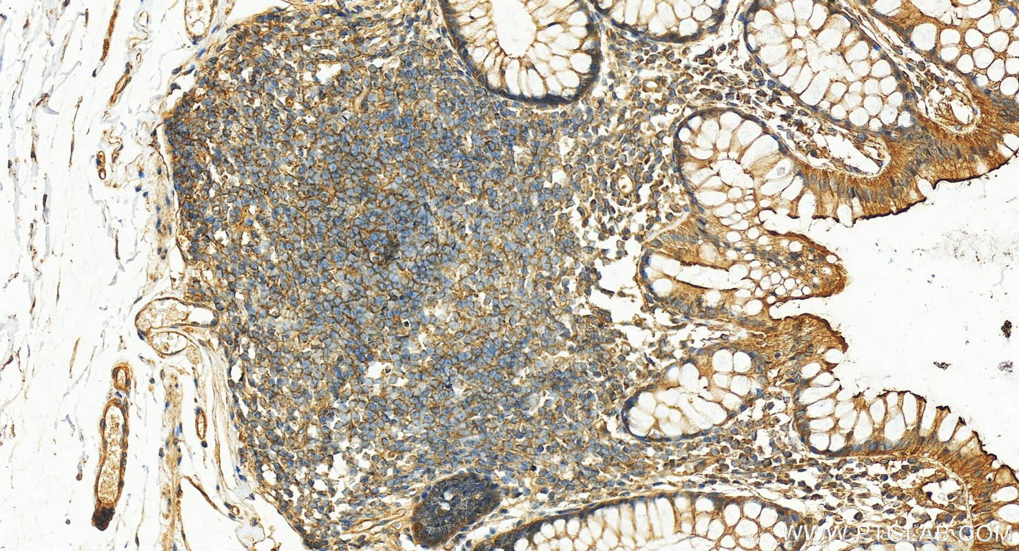 IHC staining of human colon using 12715-1-AP