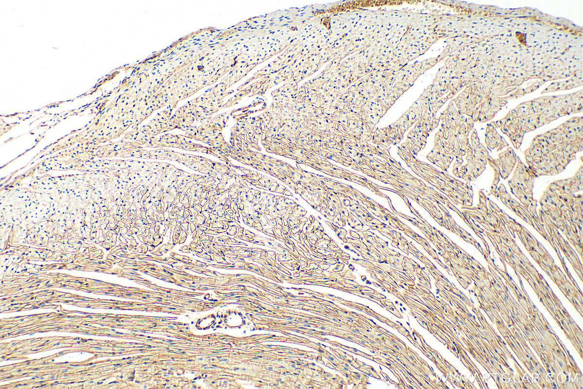 IHC staining of mouse heart using 12715-1-AP